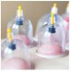 4Fizjo 1169 Fireless Vacuum Cupping Set, 12 pcs