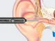Smart Ear Otoscope Endoscope with WiFi Camera, 6 Tips