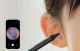 Набор насадок для отоскопа Bebird ENT Kit Черный 3 шт.