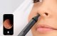 Otoscope Tips Kit Bebird ENT Kit Black 3-Pack