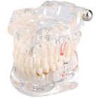 Anatomical Dental Teeth Jaw Model