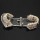Dental Jaw Model with 14 Removable Teeth & Implants