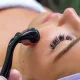 Мезороллер Derma Roller для массажа лица 0.5мм, темно-фиолетовый