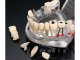 Dental Model Jaw Teeth Implants