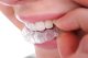 Anti Grinding Night Dental Teeth Mouth Guard Protection