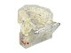 Dental Jaw Model with 14 Removable Teeth & Implants