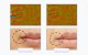 Ultrasonic facial massager with light therapy ANLAN 01-ADRY15-001