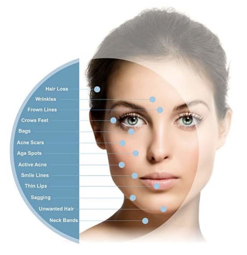 Derma Roller Face and Body Massager Needle Mesotherapy 1mm, Rose Gold (2)