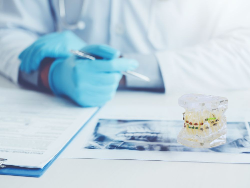 Dental model jaw teeth braces (1)