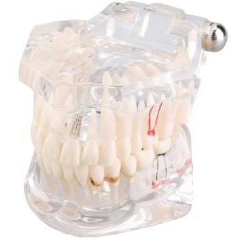 Anatomical Dental Teeth Jaw Model