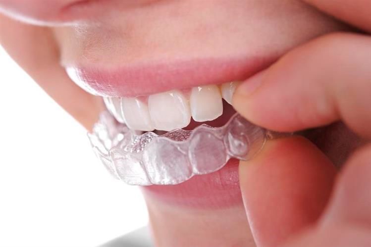 Anti Grinding Night Dental Teeth Mouth Guard Protection (4)