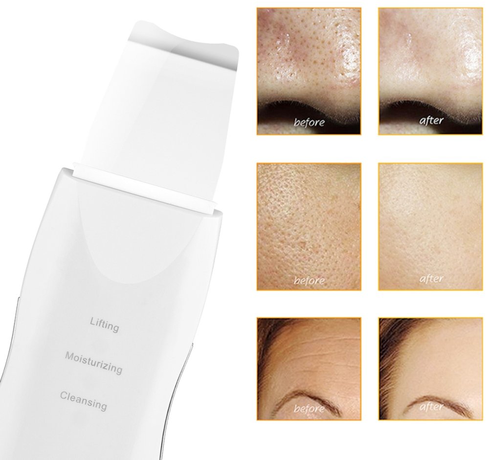 Cavitation peeling device white (3)