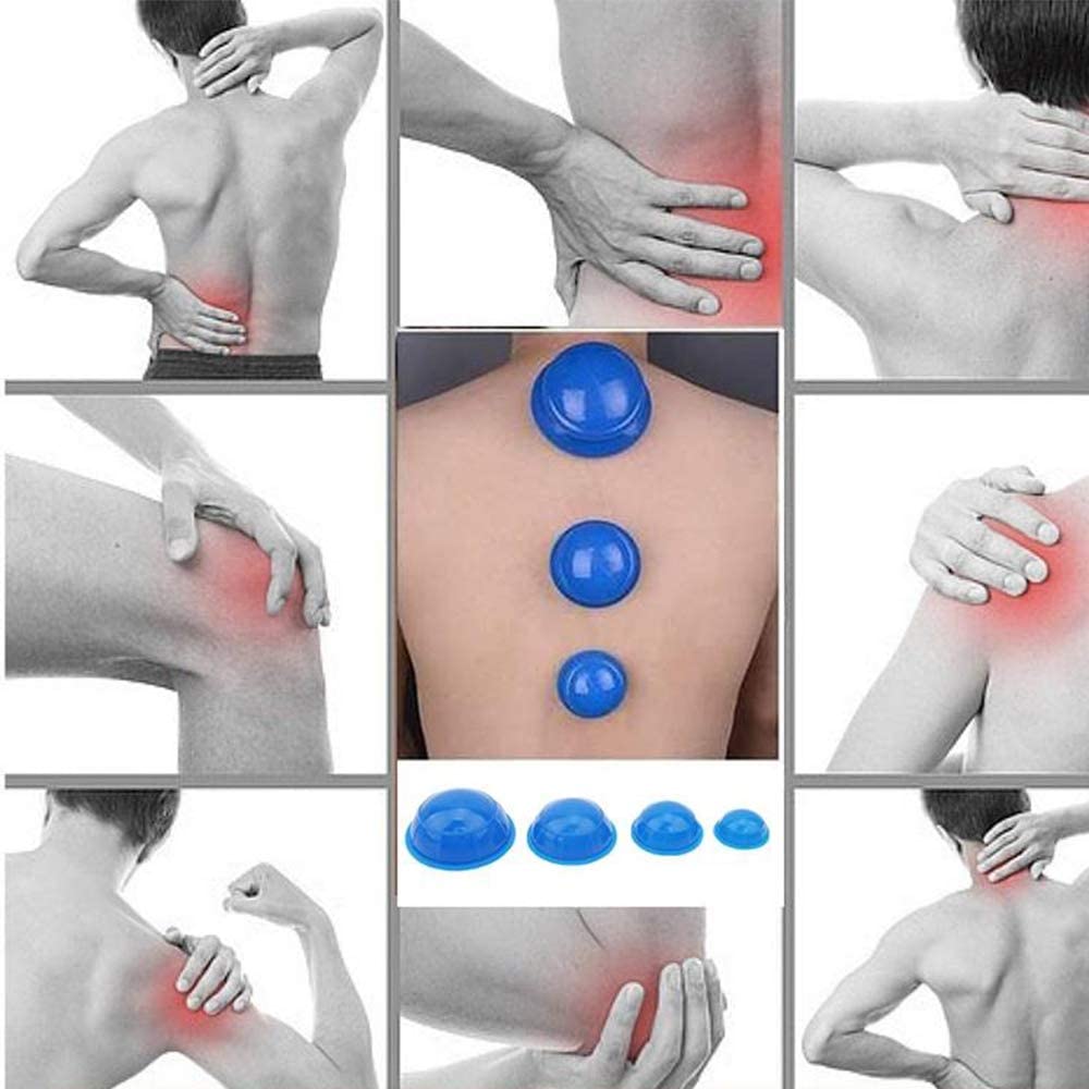 4FIZJO Acupuncture Vacuum Massage Cupping Bubbles Jars Cups, 4 pcs., Blue (2)
