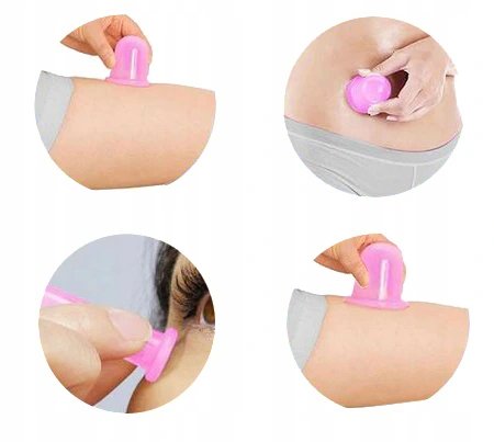 Silicone Vacuum Suction Body Face Massage Cups 4 pcs + Manual Anti Cellulite Massage Roller, Different Colors (2)