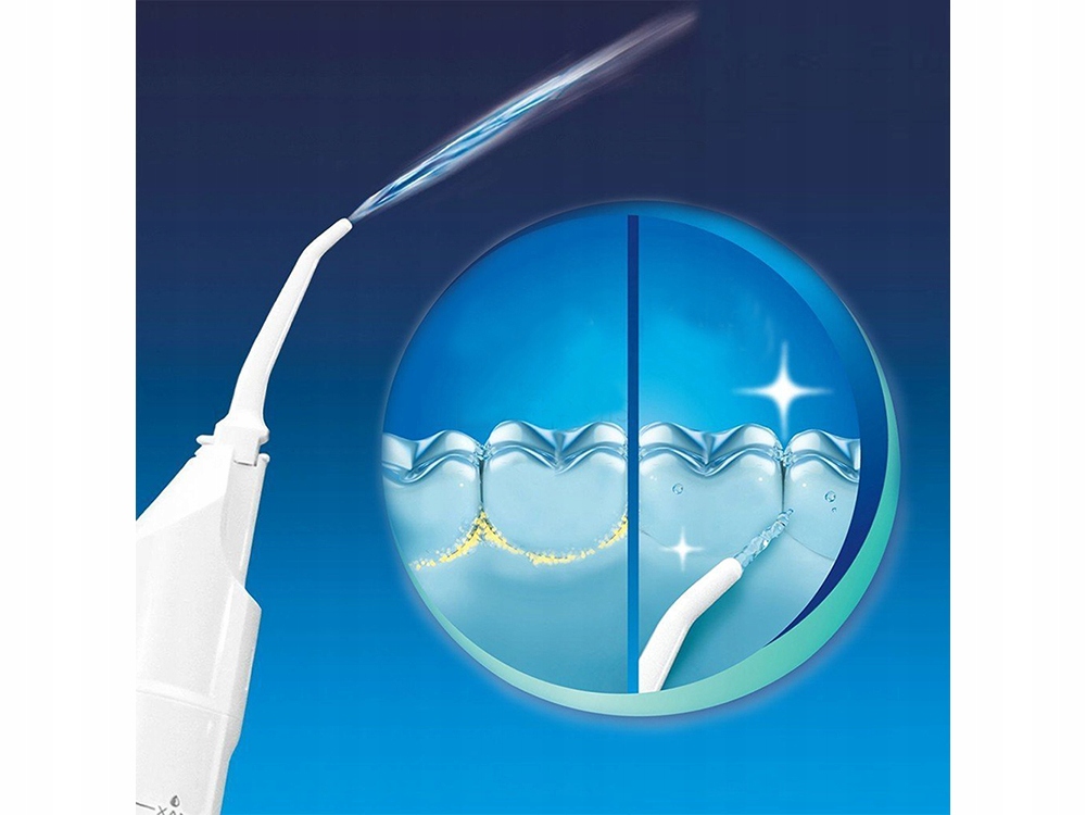 Oral Dental Water Irrigator Water Flosser for Tooth Braces without Batteries (2)
