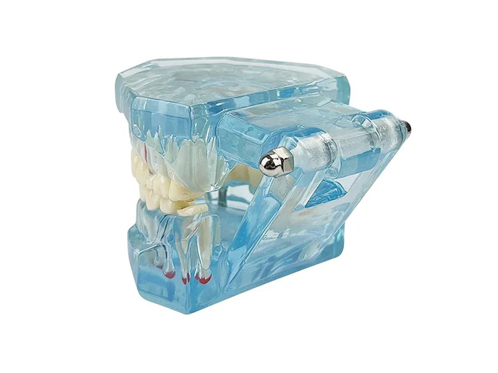 Dental Model Jaw Teeth Implants (0)