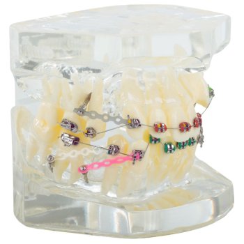 Zobu modelis žokļa zobi zobu breketes | Dental model jaw teeth braces